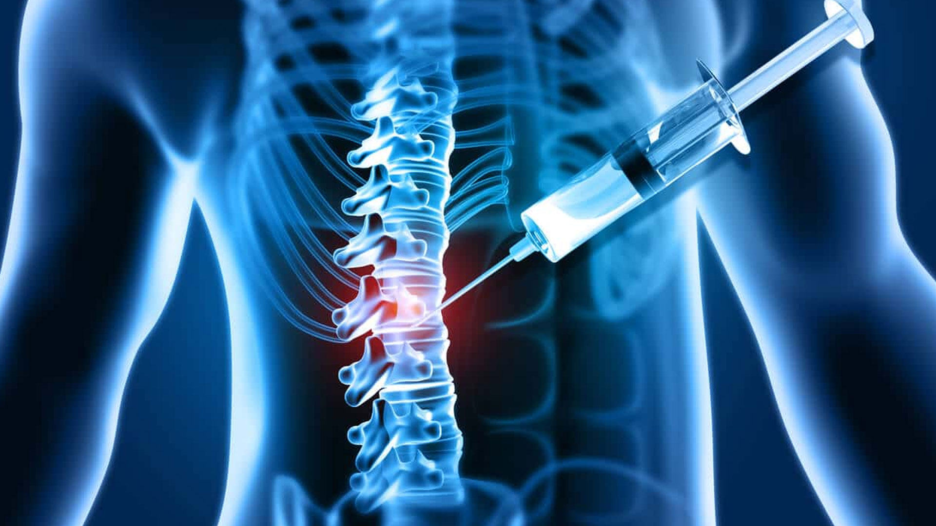 Prolapsed Disc Treatment by Dr. Sourabh Jatkar