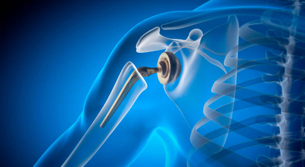 Best Joint Replacement Specialist in Kokan Nagar,Bhandup
